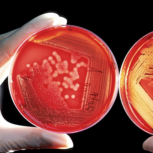 Louis Pasteur can be attributed with the formal discovery of Germ Theory